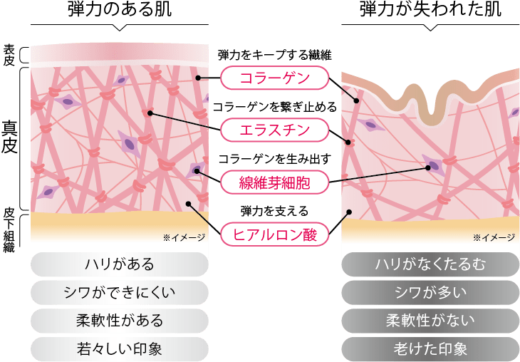 土台である真皮がくずれると表面もシワシワに!